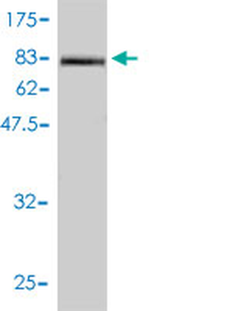 ICAM1 monoclonal antibody (M01), clone 3H8-2G6