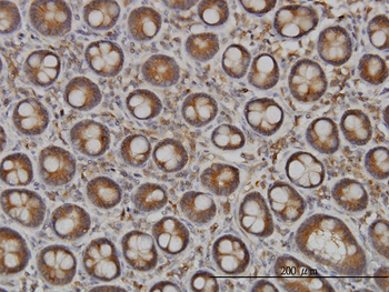 NDST1 monoclonal antibody (M01), clone 1G10