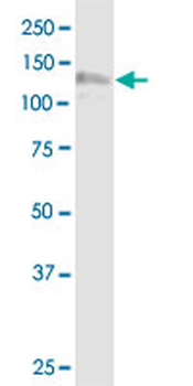 NDST1 monoclonal antibody (M01), clone 1G10
