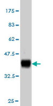 NDST1 monoclonal antibody (M01), clone 1G10