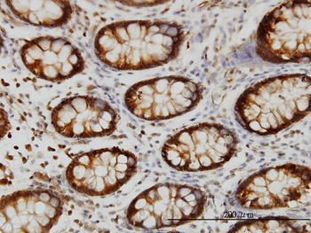 HSPA2 monoclonal antibody (M06), clone S51