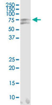 HSPA2 monoclonal antibody (M06), clone S51