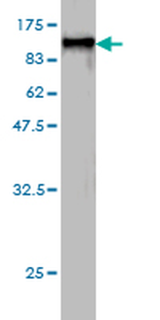HSPA2 monoclonal antibody (M06), clone S51