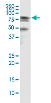 HSPA2 monoclonal antibody (M03), clone 2D11