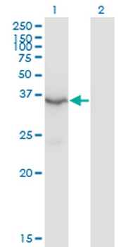 HSD3B2 monoclonal antibody (M02), clone 1E8