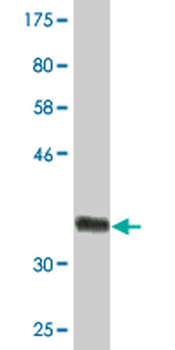 HSD3B2 monoclonal antibody (M02), clone 1E8