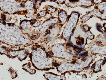 HSD3B1 monoclonal antibody (M01), clone 3C11-D4