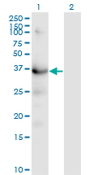 HSD3B1 monoclonal antibody (M01), clone 3C11-D4