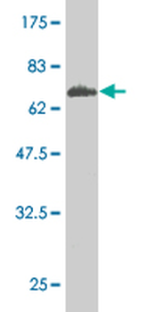 HSD3B1 monoclonal antibody (M01), clone 3C11-D4