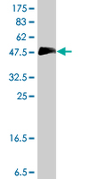 HOXC10 polyclonal antibody (A02)