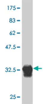 HOXB7 monoclonal antibody (M03), clone 4C6