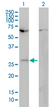 HOXB7 monoclonal antibody (M01), clone 4F9