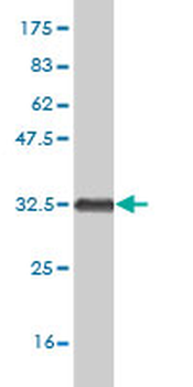 HOXB7 monoclonal antibody (M01), clone 4F9