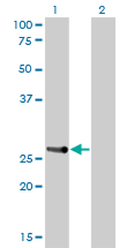 HOXA7 monoclonal antibody (M01), clone 2F2