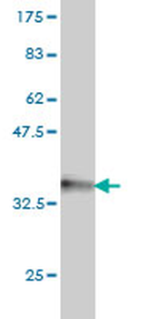 HOXA7 monoclonal antibody (M01), clone 2F2