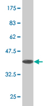 HOXA6 monoclonal antibody (M01), clone 3A6