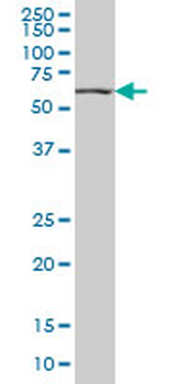 HNF4A monoclonal antibody (M04), clone 4E2