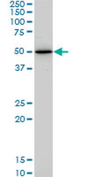 HNF4A monoclonal antibody (M04), clone 4E2
