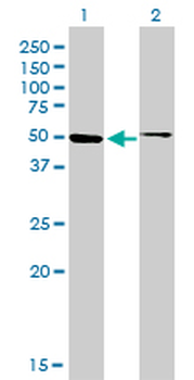 HNF4A monoclonal antibody (M04), clone 4E2