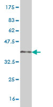 HNF4A monoclonal antibody (M04), clone 4E2