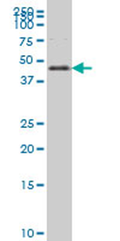 FOXA2 monoclonal antibody (M12), clone 6C12