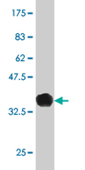 FOXA2 monoclonal antibody (M12), clone 6C12