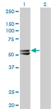 HMGCS2 monoclonal antibody (M06), clone 1E9