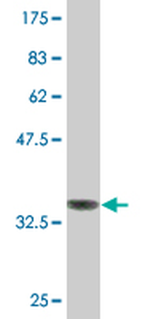 HMGCS2 monoclonal antibody (M06), clone 1E9