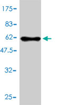 HMGCL monoclonal antibody (M01), clone 4F4-D1