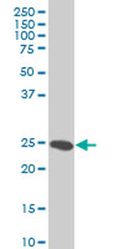 HMGB2 monoclonal antibody (M03), clone 3C7
