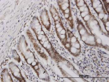 HMGB2 monoclonal antibody (M03), clone 3C7