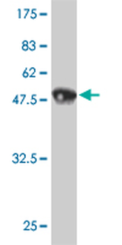 HMGB2 monoclonal antibody (M03), clone 3C7