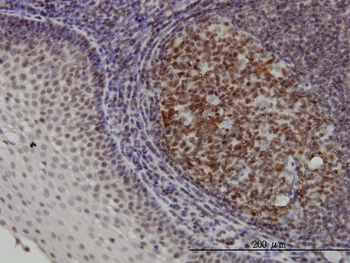 HMGB1 monoclonal antibody (M03), clone 1B11