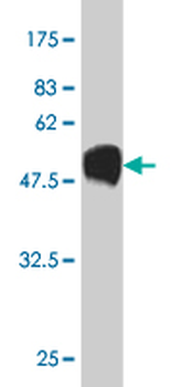 HMGB1 monoclonal antibody (M03), clone 1B11