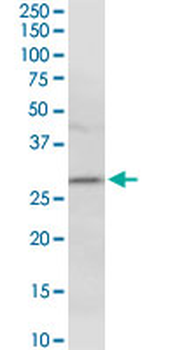 HLA-DMA purified MaxPab rabbit polyclonal antibody (D01P)
