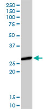 HLA-DMA purified MaxPab rabbit polyclonal antibody (D01P)