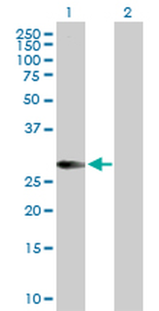 HLA-DMA purified MaxPab rabbit polyclonal antibody (D01P)
