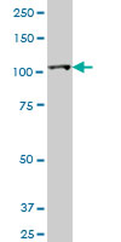 HK2 monoclonal antibody (M01), clone 4H1