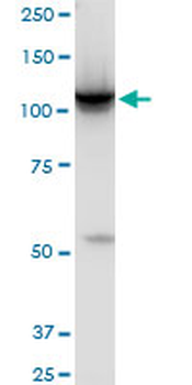 HK2 monoclonal antibody (M01), clone 4H1