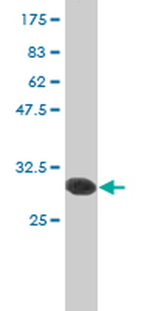 HK2 monoclonal antibody (M01), clone 4H1