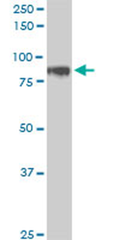 HIC1 monoclonal antibody (M01), clone 4E11