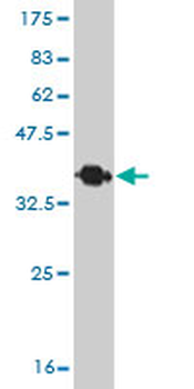 HIC1 monoclonal antibody (M01), clone 4E11