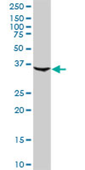CFHR1 purified MaxPab rabbit polyclonal antibody (D01P)