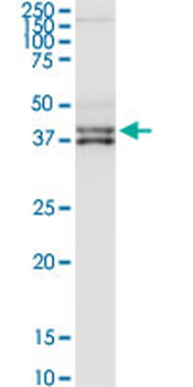 CFHR1 purified MaxPab rabbit polyclonal antibody (D01P)