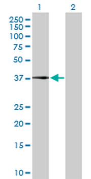 CFHR1 purified MaxPab rabbit polyclonal antibody (D01P)