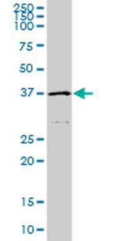 HFE monoclonal antibody (M01), clone 1G12