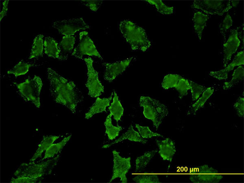 HFE monoclonal antibody (M01), clone 1G12