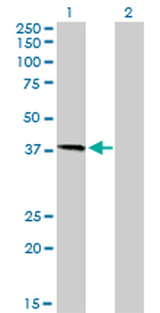 HFE monoclonal antibody (M01), clone 1G12