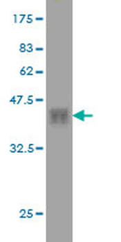 HFE monoclonal antibody (M01), clone 1G12