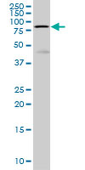HCLS1 monoclonal antibody (M01), clone 3D5